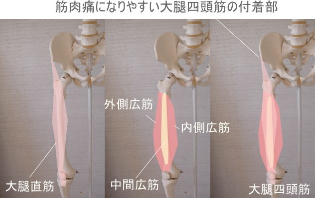 筋肉痛のスジとツボ