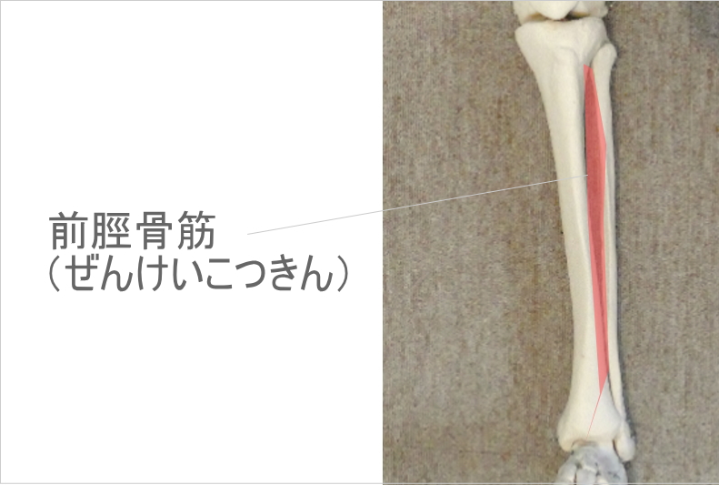 すねが痛いときのスジ