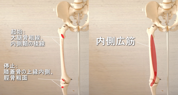 膝蓋骨に停止する内側広筋