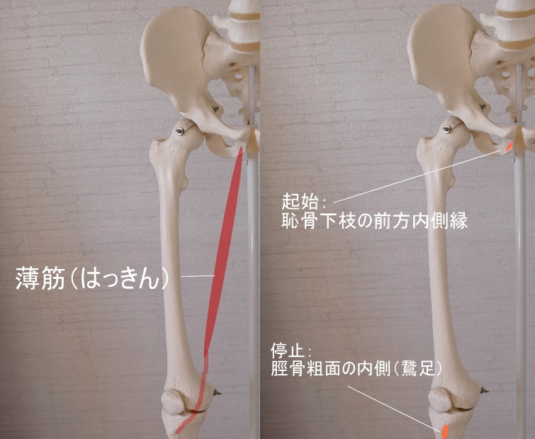 骨盤（恥骨）を起始とす薄筋