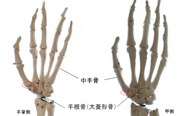 母指の鞍関節